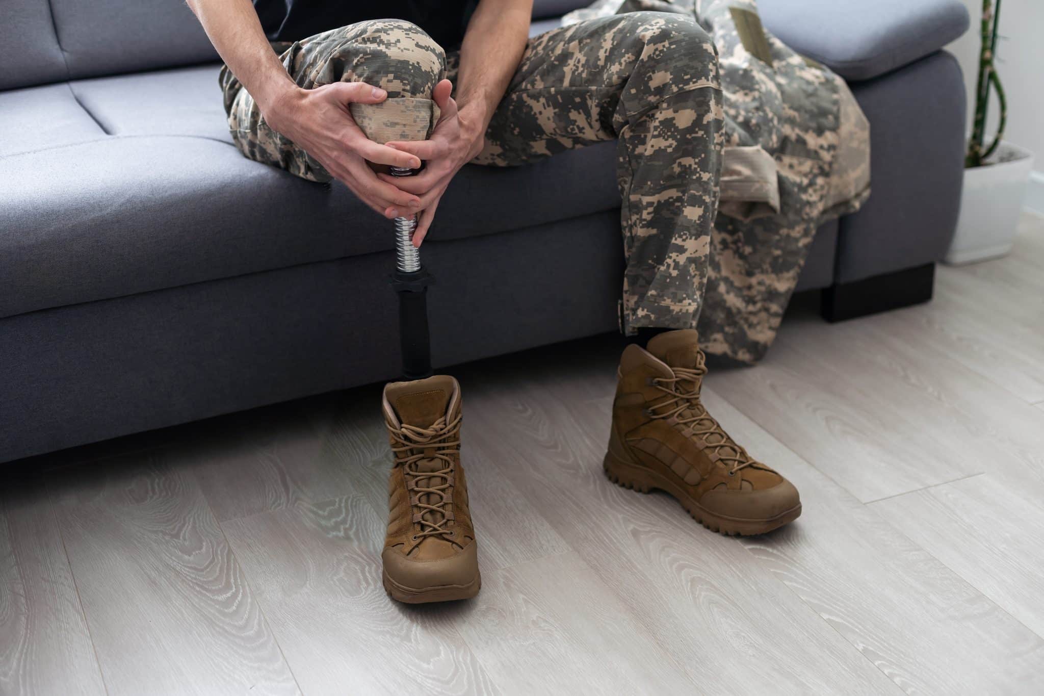 Soldier Artificial Prosthetic leg. War Veteran